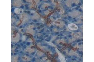 Used in DAB staining on fromalin fixed paraffin- embedded pancreas tissue