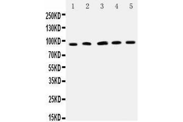 ICAM1 anticorps  (AA 198-537)