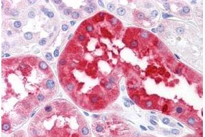 Human Kidney: Formalin-Fixed, Paraffin-Embedded (FFPE)