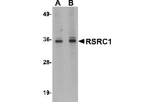 Western Blotting (WB) image for anti-arginine/serine-Rich Coiled-Coil 1 (RSRC1) (C-Term) antibody (ABIN1030630) (RSRC1 anticorps  (C-Term))