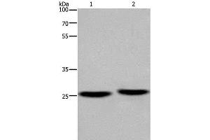 Western Blot analysis of Mouse brain and Human fetal muscle tissue using EPDR1 Polyclonal Antibody at dilution of 1:850 (EPDR1 anticorps)
