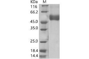 West Nile Virus NS1 (WNV NS1) protein (His tag)