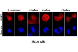 Immunofluorescenitrocellulosee of human HeLa cells stained with Hoechst 3342 (Blue) for chromatin staining and monoclonal anti-human Aurora kinase B antibody (1:2000) with Texas Red (Red). (Aurora Kinase B anticorps  (AA 1-344))