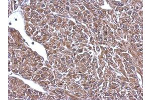 IHC-P Image Immunohistochemical analysis of paraffin-embedded U87 xenograft, using 68kDa Neurofilament Light, antibody at 1:500 dilution.