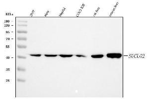 Western blot analysis of SUCLG2 using anti-SUCLG2 antibody (ABIN7601694). (SUCLG2 anticorps  (AA 42-424))