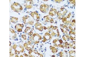 Immunohistochemistry of paraffin-embedded Human stomach using C1QC Polyclonal Antibody at dilution of 1:100 (40x lens). (C1QC anticorps)