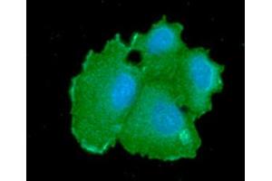 ICC/IF analysis of CBR1 in Hep3B cells line, stained with DAPI (Blue) for nucleus staining and monoclonal anti-CBR1 antibody (1:100) with goat anti-mouse IgG-Alexa fluor 488 conjugate (Green).