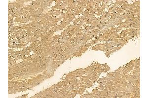 SMAP2 Mouse Monoclonal Antibody at 1/100 staining rat heart tissue by IHC-P. (SMAP2 anticorps)