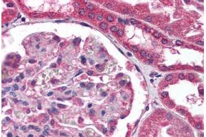 Human Kidney (formalin-fixed, paraffin-embedded) stained with COL18A1 antibody ABIN307188 at 1:100 followed by biotinylated anti-mouse IgG secondary antibody ABIN481714, alkaline phosphatase-streptavidin and chromogen. (COL18A1 anticorps)