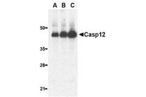 Western blot analysis of caspase-12 in human heart lysate with AP30192PU-N caspase-12 antibody (large) at 0.