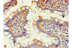 Immunohistochemistry of paraffin-embedded human small intestine tissue using ABIN7143685 at dilution of 1:100