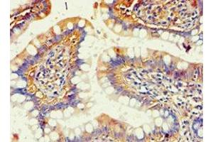 Immunohistochemistry of paraffin-embedded human small intestine tissue using ABIN7143685 at dilution of 1:100 (AKR1B1 anticorps  (AA 1-316))