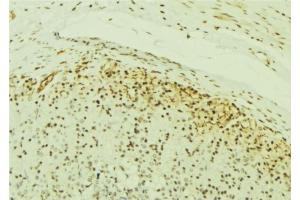ABIN6277054 at 1/100 staining Human gastric tissue by IHC-P. (IKK alpha anticorps  (N-Term))