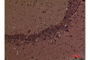 Immunohistochemistry (IHC) analysis of paraffin-embedded Mouse Brain, antibody was diluted at 1:100. (INPPL1 anticorps  (Internal Region))