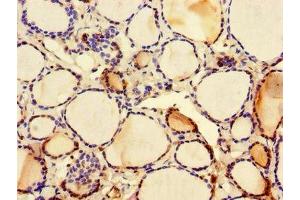 Immunohistochemistry of paraffin-embedded human thyroid tissue using ABIN7146159 at dilution of 1:100 (C2CD3 anticorps  (AA 2079-2265))