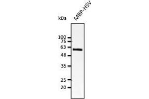Western Blotting (WB) image for anti-HSV Tag antibody (ABIN7272989) (HSV Tag anticorps)