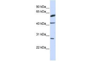 RNF170 antibody used at 1 ug/ml to detect target protein. (RNF170 anticorps  (Middle Region))