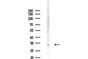 anti-Growth Factor Independent 1B Transcription Repressor (GFI1B) (Internal Region) antibody