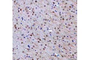 IHC analysis of RTF1 using anti-RTF1 antibody (ABIN7602444). (RTF1 anticorps  (AA 77-705))