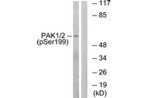 Western blot analysis of extracts from LOVO cells treated with starved 24h, using PAK1 (Phospho-Ser199) Antibody. (PAK1 anticorps  (pSer199))
