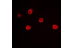 Immunofluorescent analysis of MYF5 staining in Jurkat cells.