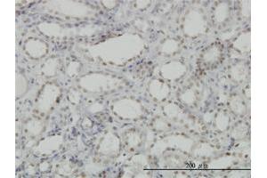 Immunoperoxidase of monoclonal antibody to CDKL1 on formalin-fixed paraffin-embedded human kidney. (CDKL1 anticorps  (AA 259-358))