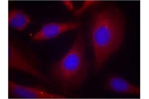 Image no. 2 for anti-Nuclear Factor of kappa Light Polypeptide Gene Enhancer in B-Cells 1 (NFKB1) (Ser927) antibody (ABIN319347)