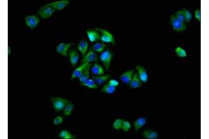 Immunofluorescence staining of Hela cells with ABIN7153969 at 1:100, counter-stained with DAPI.