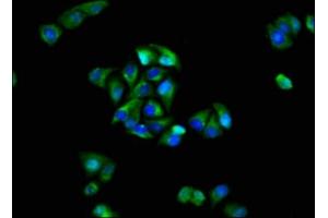 Immunofluorescence staining of Hela cells with ABIN7153969 at 1:100, counter-stained with DAPI. (GRIK1 anticorps  (AA 675-834))