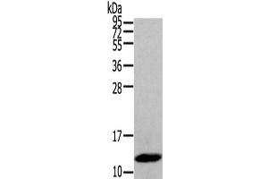 Western Blot analysis of Human placenta tissue using DEFB112 Polyclonal Antibody at dilution of 1/200 (DEFB112 anticorps)