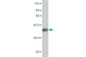 Western Blot detection against Immunogen (36. (PFN2 anticorps  (AA 41-140))
