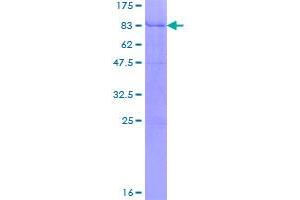 Image no. 1 for Lipoprotein Lipase (LPL) (AA 1-475) protein (GST tag) (ABIN1309705)