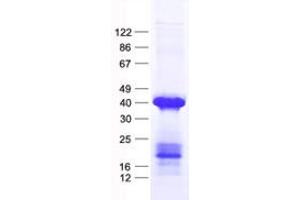 Validation with Western Blot (SPI1 Protein (His tag))