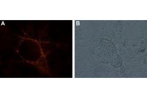Expression of kainate receptor GluK1 in rat DRG neurons - Cell surface detection of kainate receptor GluK1 in living rat dorsal root ganglion (DRG). (GRIK1 anticorps  (Extracellular, N-Term))