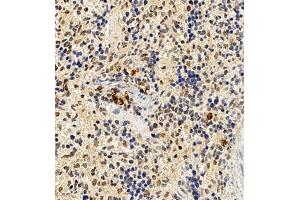 Immunohistochemistry of paraffin embedded mouse spleen using CCRL2 (ABIN7073461) at dilution of 1:300 (400x lens) (CCRL2 anticorps)