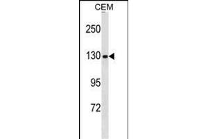 NCG Antibody (N-term) 19113a western blot analysis in CEM cell line lysates (35 μg/lane). (NCAPG anticorps  (N-Term))