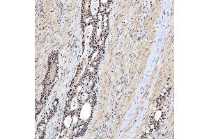 IHC analysis of SNRNP200 using anti-SNRNP200 antibody (ABIN7602032).