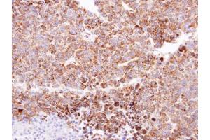 IHC-P Image Immunohistochemical analysis of paraffin-embedded H520 xenograft, using CLPP, antibody at 1:100 dilution.