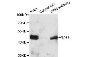 Immunoprecipitation analysis of 150ug extracts of A549 cells using 3ug TP53 antibody.