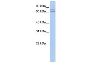 DDX27 antibody used at 1 ug/ml to detect target protein. (DDX27 anticorps)