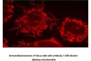 Image no. 1 for anti-Inner Membrane Protein, Mitochondrial (IMMT) antibody (ABIN363364) (IMMT anticorps)