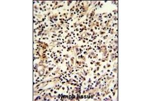 Formalin-fixed and paraffin-embedded human lymph reacted with PCM-1 Antibody (C-term), which was peroxidase-conjugated to the secondary antibody, followed by DAB staining.