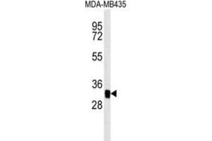 Western Blotting (WB) image for anti-Mitochondrial Carrier 2 (MTCH2) antibody (ABIN3002367) (MTCH2 anticorps)