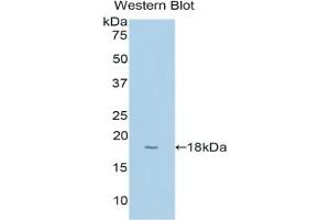 Detection of Recombinant CYP1B1, Human using Polyclonal Antibody to Cytochrome P450 1B1 (CYP1B1) (CYP1B1 anticorps  (AA 374-516))
