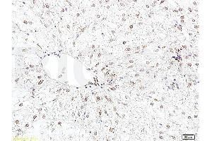 Formalin-fixed and paraffin embedded rat liver tissue labeled with Anti-Bcl-2 Polyclonal Antibody, Unconjugated (ABIN723920) 1:400 followed by conjugation to the secondary antibody and DAB staining