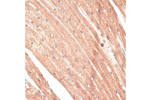 Immunohistochemistry of paraffin-embedded mouse heart using KTN1 antibody. (KTN1 anticorps  (AA 1-100))