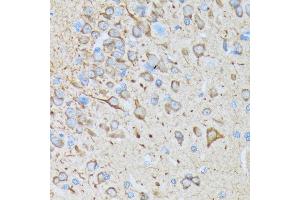 Immunohistochemistry of paraffin-embedded rat brain using CaMKII Rabbit mAb (ABIN3015112, ABIN3015113, ABIN1679768 and ABIN1679769) at dilution of 1:100 (40x lens). (CAMK2B anticorps)