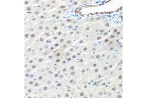 Immunohistochemistry of paraffin-embedded rat liver using PRPF19 antibody (ABIN6293423) at dilution of 1:100 (40x lens). (PRP19 anticorps)