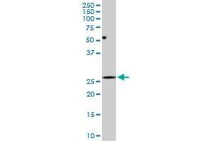 DCUN1D1 monoclonal antibody (M01), clone 3D7.