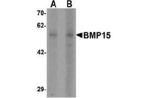 Western blot analysis of BMP15 in 3T3 cell lysate with BMP15 Antibody  at (A) 1 and (B) 2 µg/ml (BMP15 anticorps  (N-Term))